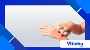 Dicas para Evitar Alergias a Produtos Químicos